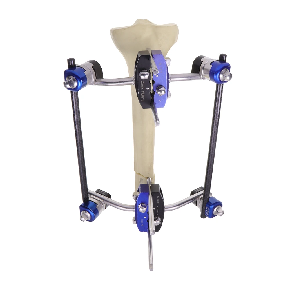CareFix Combined External Fixator
CareFix Combined External Fixator