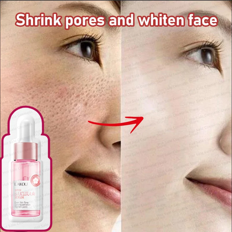 Sakura Tighten Pores Whitening Face Serum Fade Fine Lines Anti Aging Improve Melanin Pigment Dull Moisturizer Brighten Skin Care
Sakura Tighten Pores Whitening Face Serum Fade Fine Lines Anti Aging Improve Melanin Pigment Dull Moisturizer Brighten Skin Care