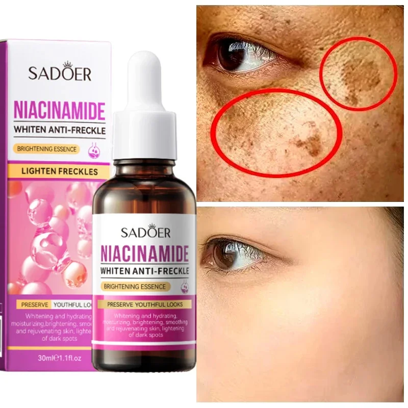 Nicotinamide Salicylic Acid Reduces Stain Facial Essence Whitens Moisturizes Tightens Reduces Melanin Essence Skin Beauty Health
Nicotinamide Salicylic Acid Reduces Stain Facial Essence Whitens Moisturizes Tightens Reduces Melanin Essence Skin Beauty Health