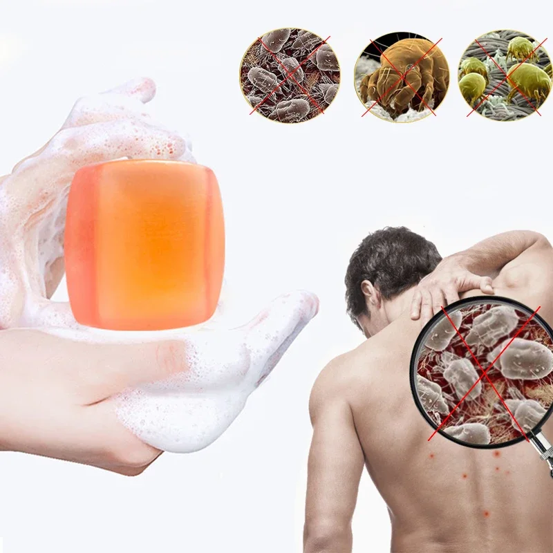 Mite Removal Handcrafted Soap for Men Women Control Blackheads Honey Oil Soap Moisturizing Whitening Hand Soap jabón savon
Mite Removal Handcrafted Soap for Men Women Control Blackheads Honey Oil Soap Moisturizing Whitening Hand Soap jabón savon