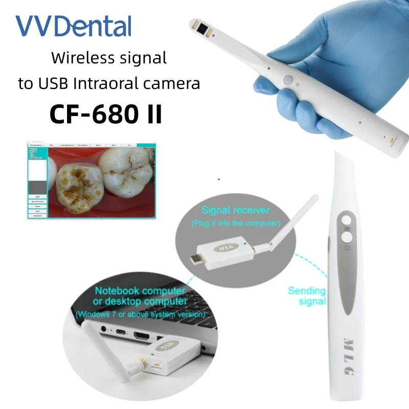 VV Dental Intraoral Camera High-Speed Transmission System for Oral Examination With 8 pcs LED light USB Intra Oral Camera
VV Dental Intraoral Camera High-Speed Transmission System for Oral Examination With 8 pcs LED light USB Intra Oral Camera