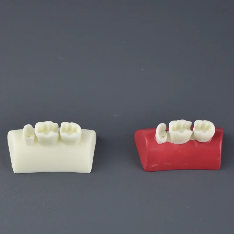 Dental Laboratory Demonstration Inlay Motion Model Conodont Model Filled with Resin Block Red and White Model
Dental Laboratory Demonstration Inlay Motion Model Conodont Model Filled with Resin Block Red and White Model