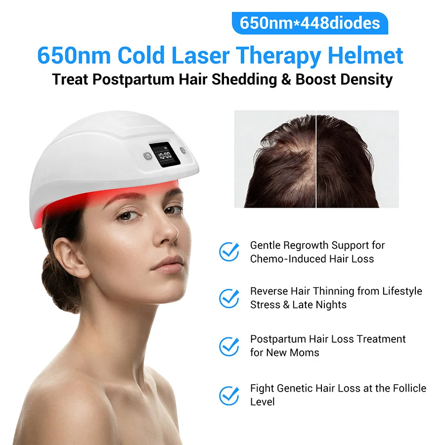 Manufacturer Supply Over the Counter Hair Loss Treatment Best Hair Loss Doctor Best Hair Loss for Men 650nm 448 Diodes Laser Cap
Manufacturer Supply Over the Counter Hair Loss Treatment Best Hair Loss Doctor Best Hair Loss for Men 650nm 448 Diodes Laser Cap