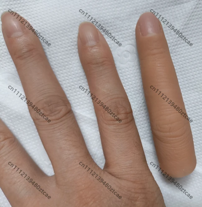 Custom Silicone Prosthetic Fingers & Toes, Cosmetic Hand Restoration Model for Broken or Damaged Fingers
Custom Silicone Prosthetic Fingers & Toes, Cosmetic Hand Restoration Model for Broken or Damaged Fingers