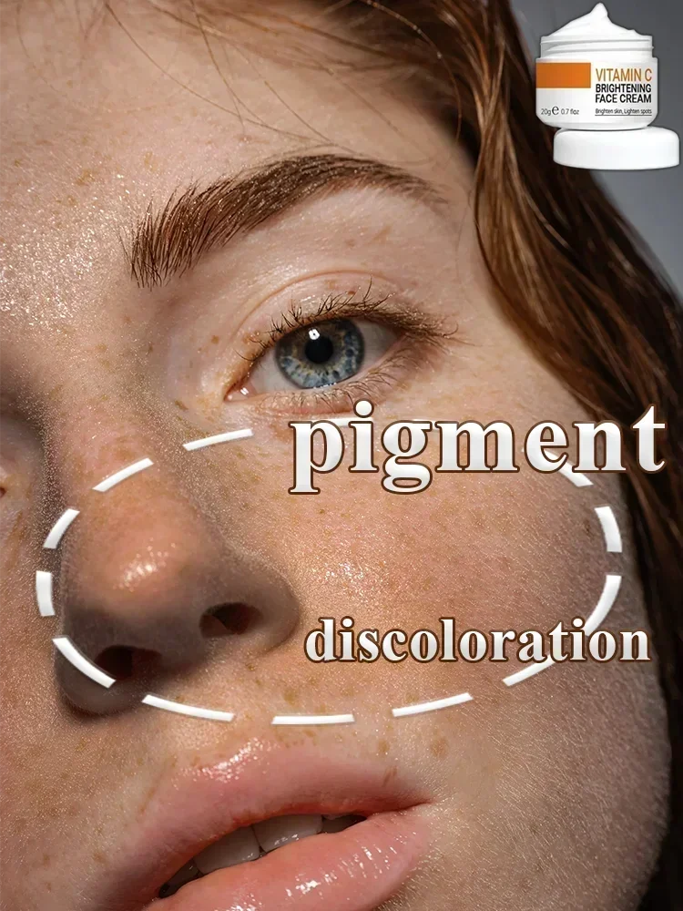 Whitening Anti-Freckle Cream Brighten Skin Tone Remove Freckles Lighten Spots Chloasma Brighten Moisturize Face Skin Care
Whitening Anti-Freckle Cream Brighten Skin Tone Remove Freckles Lighten Spots Chloasma Brighten Moisturize Face Skin Care