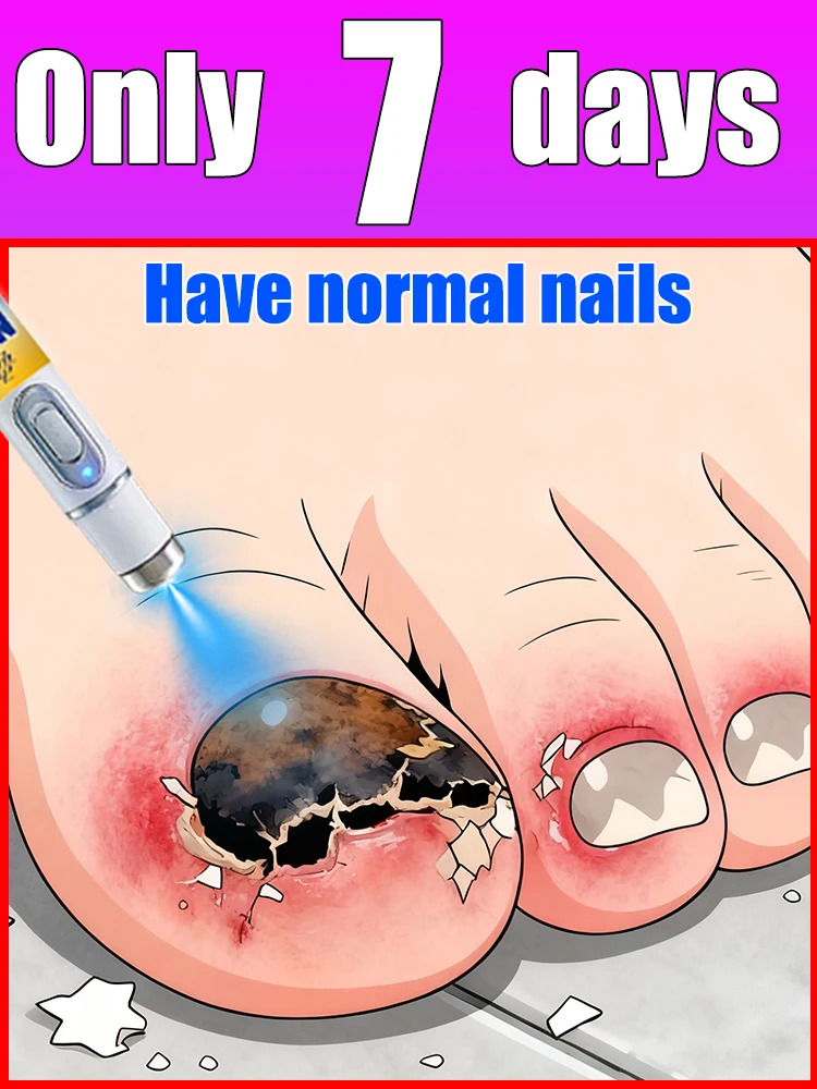 2025 г., хит продаж, инструменты для чистки ногтей, не отправляйте свою жизнь
2025 г., хит продаж, инструменты для чистки ногтей, не отправляйте свою жизнь