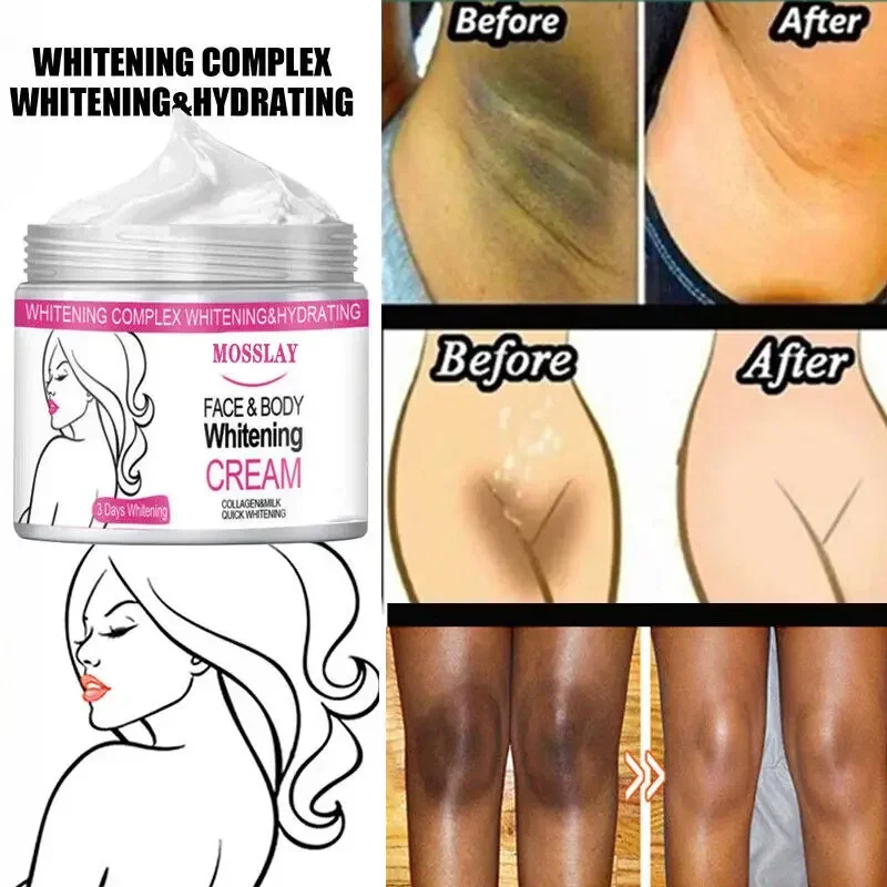 Black Skin Permanent Bleaching Cream Collagen Whitening Blemish Brightening Women's Private Parts Anti-wrinkle Essence Cream
Black Skin Permanent Bleaching Cream Collagen Whitening Blemish Brightening Women's Private Parts Anti-wrinkle Essence Cream