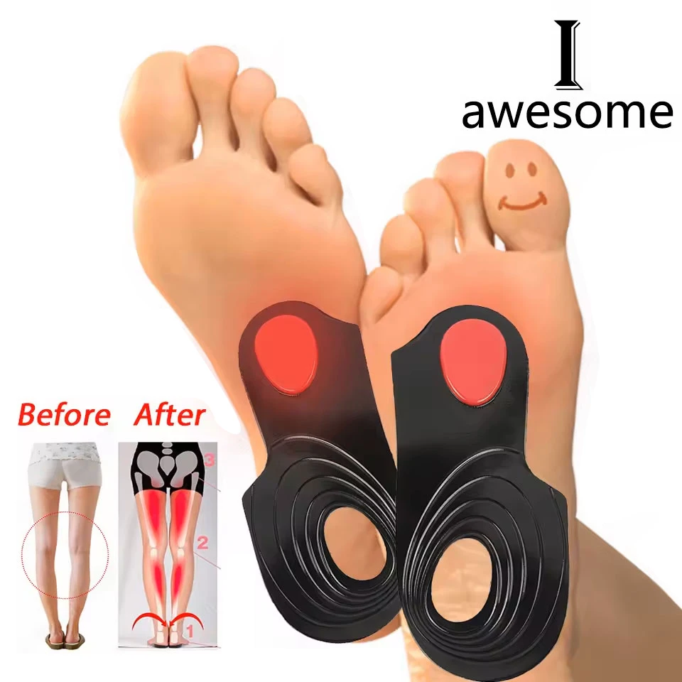 Orthopedic Flat Feet Correction Heel Pain XO-Legs Orthotic Insoles for Arch Support Shoes Inserts Soles Inserts Man Woman Unisex
Orthopedic Flat Feet Correction Heel Pain XO-Legs Orthotic Insoles for Arch Support Shoes Inserts Soles Inserts Man Woman Unisex