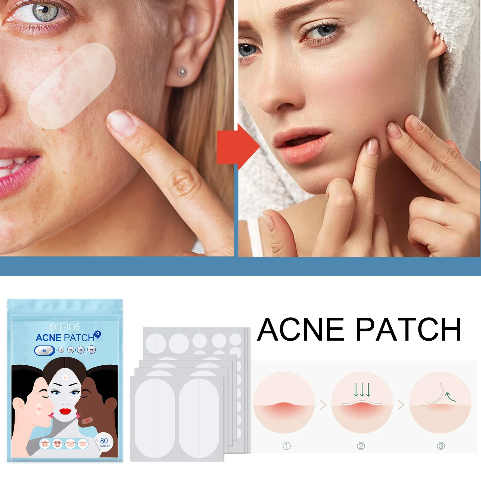 Eelhoe Invisible Acne Patch Lasting Repairing Pimple Non Irritating Waterproof Makeup Tool Acne Treatment Removal Patches 80Pcs
Eelhoe Invisible Acne Patch Lasting Repairing Pimple Non Irritating Waterproof Makeup Tool Acne Treatment Removal Patches 80Pcs