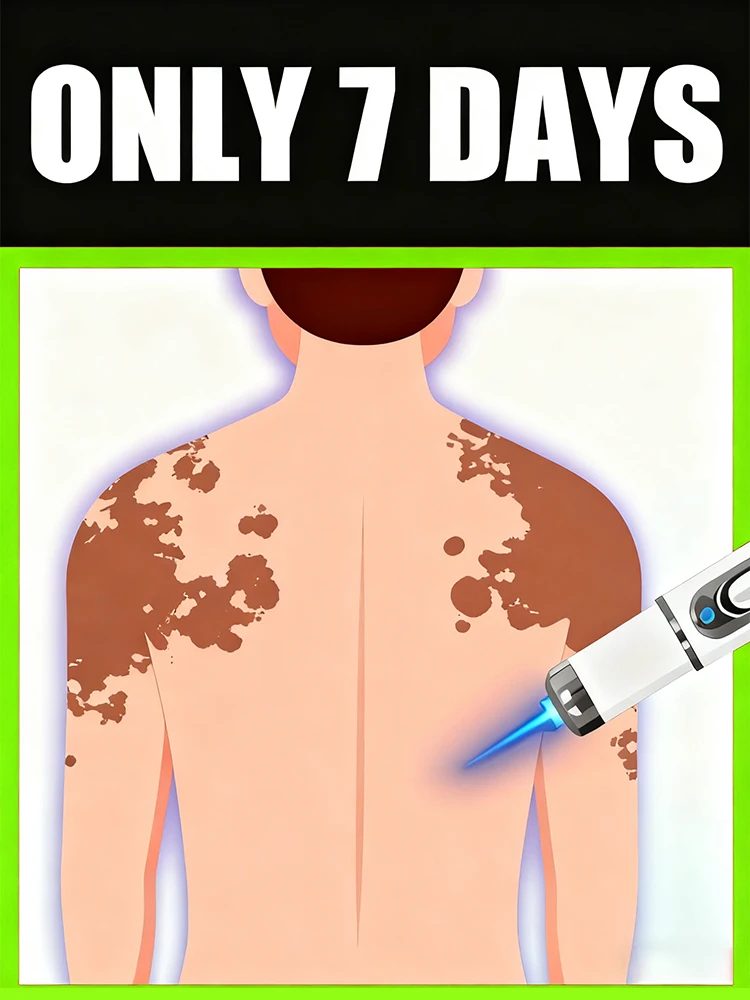 Осветляет оригинальный цвет кожного дюймов кожи со светом технологии. 
Осветляет оригинальный цвет кожного дюймов кожи со светом технологии.