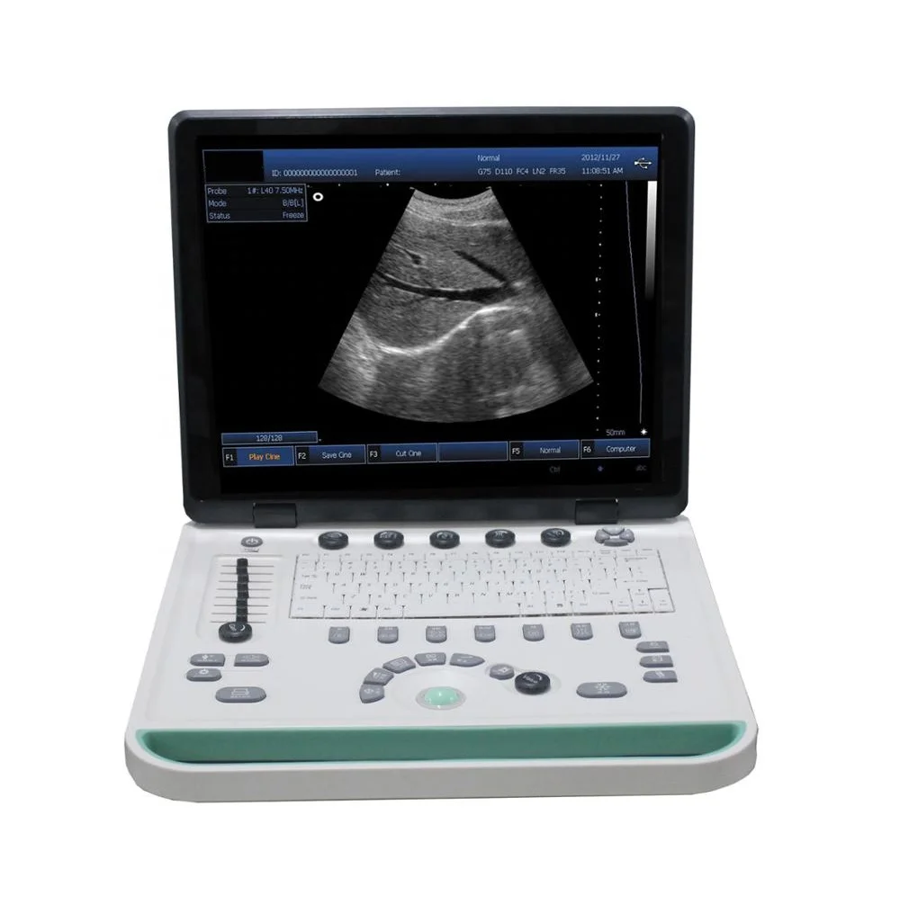 Diagnostic Medical Equipment Ultrasound Machine 3D 4D 15 inch Portable B/W Color Doppler Ultrasound
Diagnostic Medical Equipment Ultrasound Machine 3D 4D 15 inch Portable B/W Color Doppler Ultrasound
