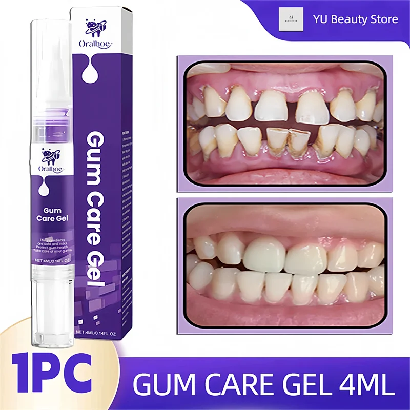 Rapid Repair Gums Serum Purple Damaged Gum Care Gel Effective Relieve Teeth Allergy Dental Caries Tooth Deep Cleaning Toothpaste
Rapid Repair Gums Serum Purple Damaged Gum Care Gel Effective Relieve Teeth Allergy Dental Caries Tooth Deep Cleaning Toothpaste