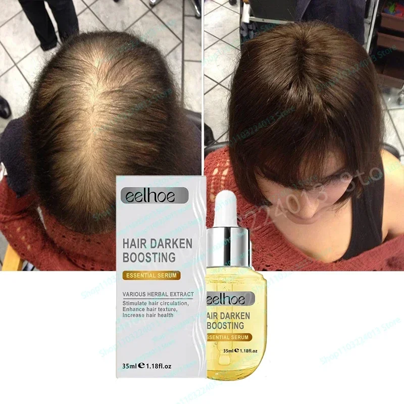 Sdottor Biotin продукты для роста волос для мужчин женщин против выпадения волос искусственные масла Лечение кожи головы сыворотка Уход за волосами
Sdottor Biotin продукты для роста волос для мужчин женщин против выпадения волос искусственные масла Лечение кожи головы сыворотка Уход за волосами