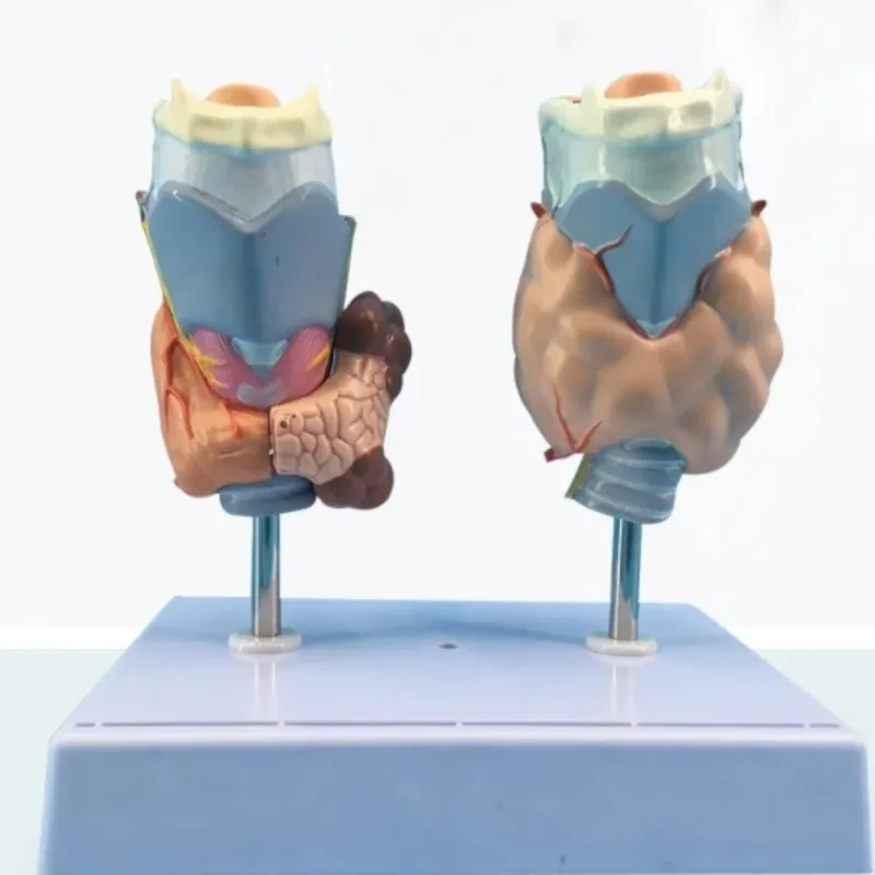 Human thyroid pathology Hyperthyroidism anatomical model Thyroid tumor medical model
Human thyroid pathology Hyperthyroidism anatomical model Thyroid tumor medical model