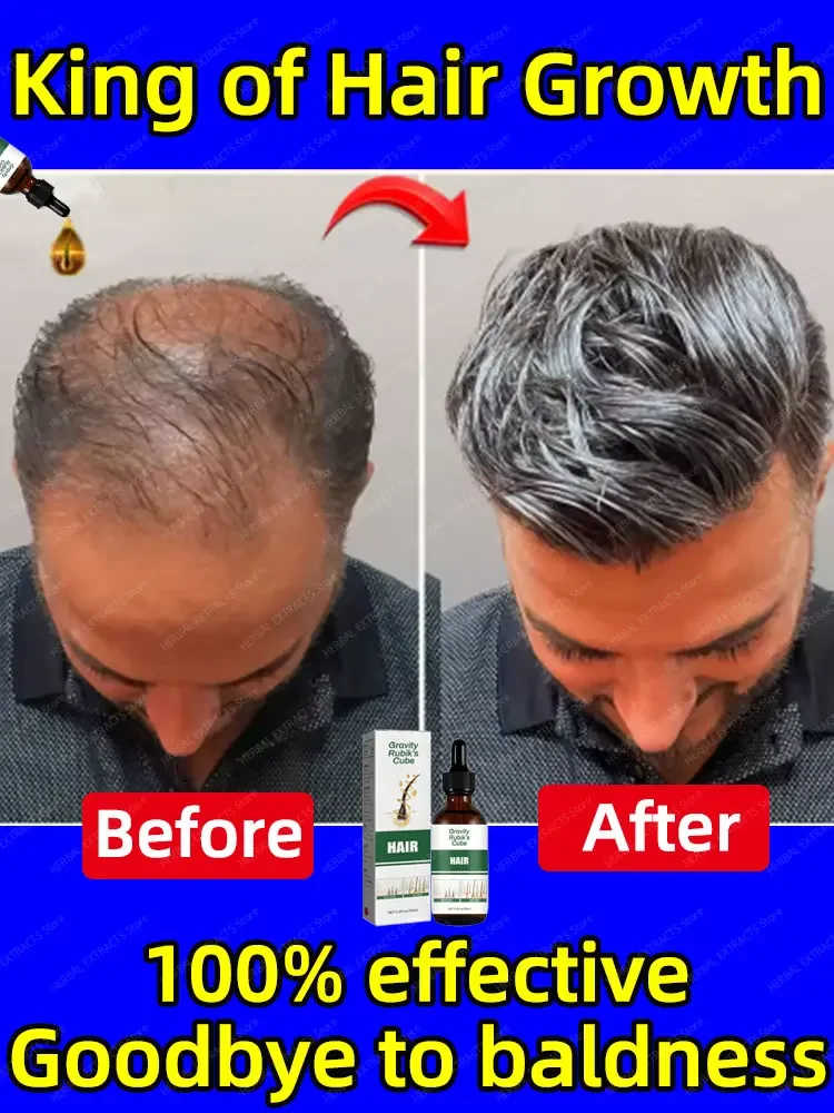 Лучшие продукты для роста волос 2022 года. Любые проблемы выпадения и облысения можно растворить и ваши волосы растится больше, чем Befor. 
Лучшие продукты для роста волос 2022 года. Любые проблемы выпадения и облысения можно растворить и ваши волосы растится больше, чем Befor.