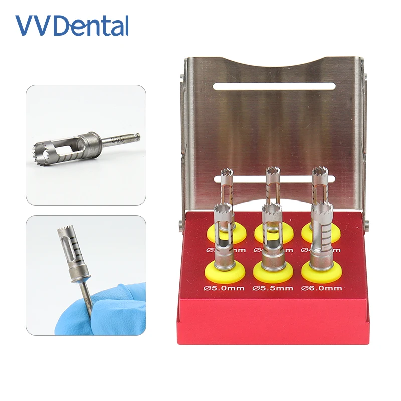 VVDental Dental Implant Bone Trephine Drill Dental Implant Positioning Bone Removal Drill Set Drills Cutting Grinding Tool
VVDental Dental Implant Bone Trephine Drill Dental Implant Positioning Bone Removal Drill Set Drills Cutting Grinding Tool