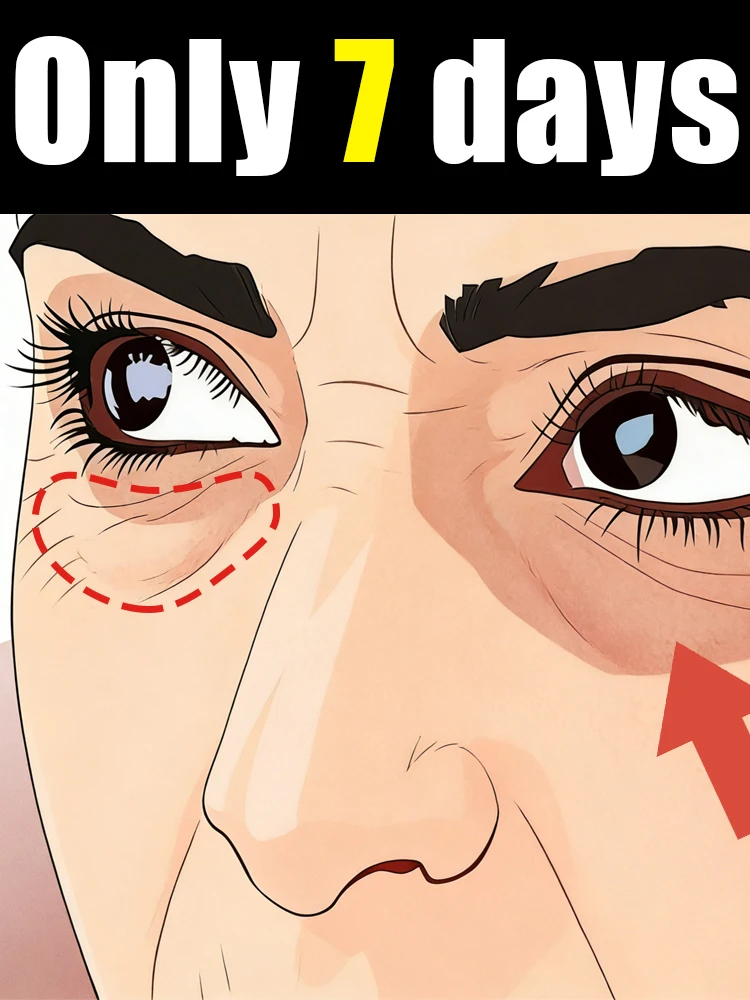 When touching your eyes, make your hands feel smooth; get rid of your worries in 7 days.
When touching your eyes, make your hands feel smooth; get rid of your worries in 7 days.