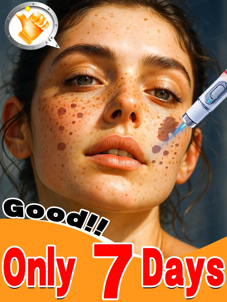 Rᴇᴍᴏᴠᴇ ᴠᴀʀɪᴏᴜs sᴘᴏᴛs Age spots and pigmentation diminish, unveiling immaculate skin. Skin care tools
Rᴇᴍᴏᴠᴇ ᴠᴀʀɪᴏᴜs sᴘᴏᴛs Age spots and pigmentation diminish, unveiling immaculate skin. Skin care tools