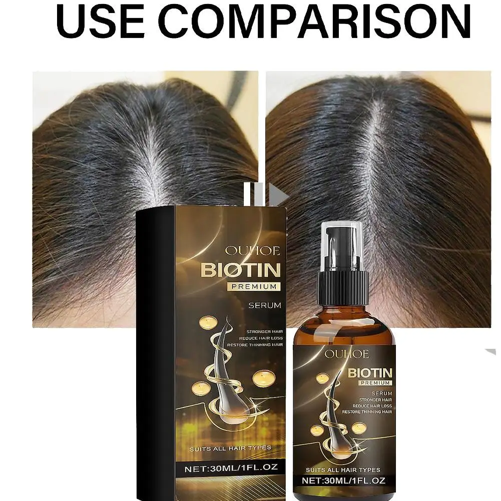 Anti-Hair Loss Essence Serum Promotes Hair Growth Improves Scalp Environment Hair Care
Anti-Hair Loss Essence Serum Promotes Hair Growth Improves Scalp Environment Hair Care