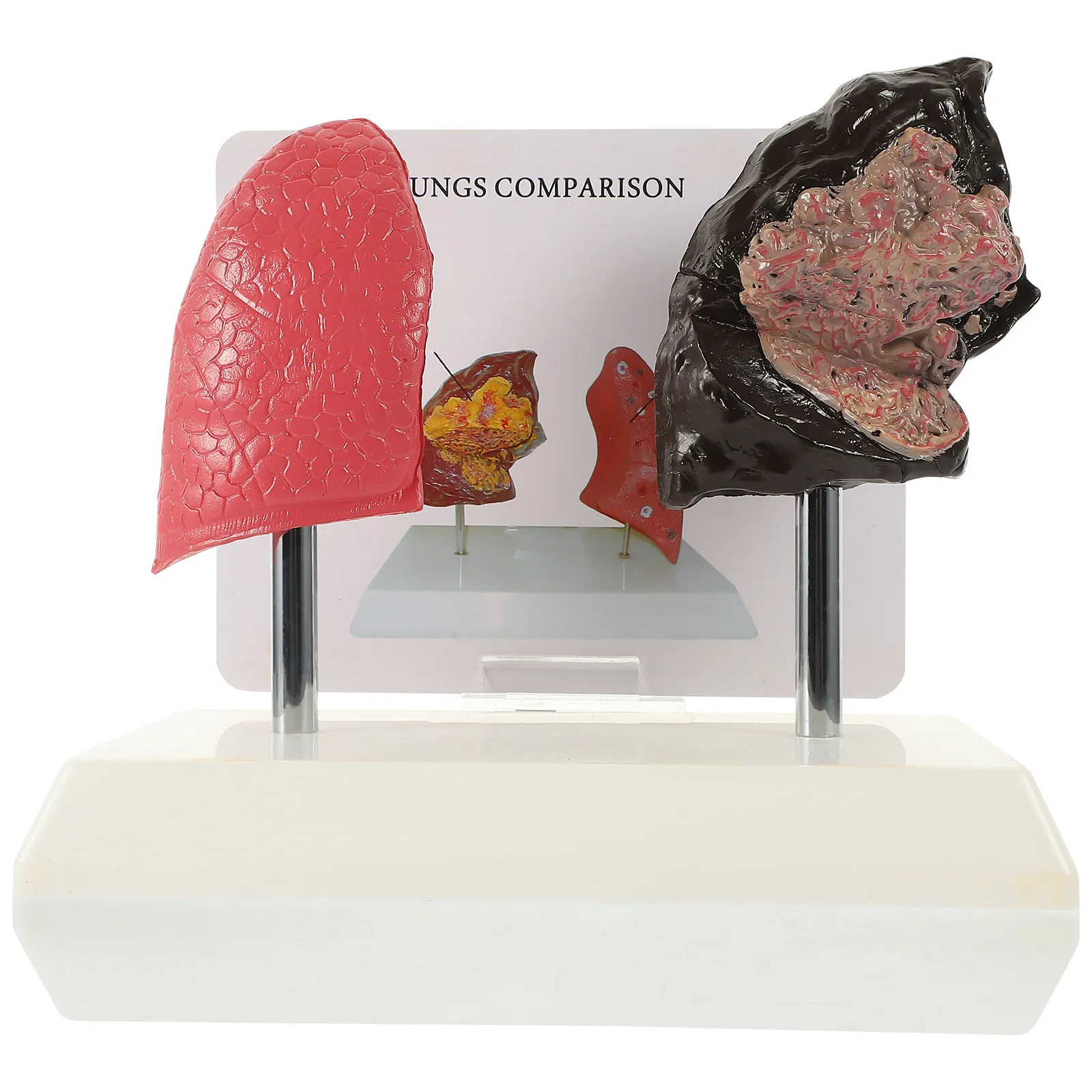 1Pcs Teaching Lung Comparison Smoking Lung Anatomy Respiratory Pathological Respiratory School Display
1Pcs Teaching Lung Comparison Smoking Lung Anatomy Respiratory Pathological Respiratory School Display