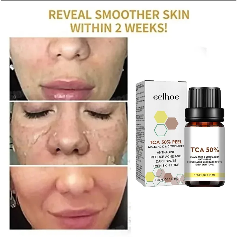 Salicylic Acid Face Facial Peel Neutraliser Face Deep At Home Chemical Peel Exfoliate Refine skin care serum NEW
Salicylic Acid Face Facial Peel Neutraliser Face Deep At Home Chemical Peel Exfoliate Refine skin care serum NEW