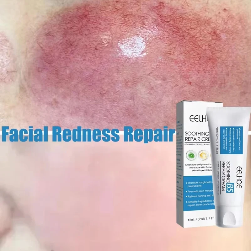 7 Day Repair Facial Redness Cream Soothing Red Blood Rosacea Treatment Improve Sensitive Skin Moisturizing Skin Care Cosmetics
7 Day Repair Facial Redness Cream Soothing Red Blood Rosacea Treatment Improve Sensitive Skin Moisturizing Skin Care Cosmetics