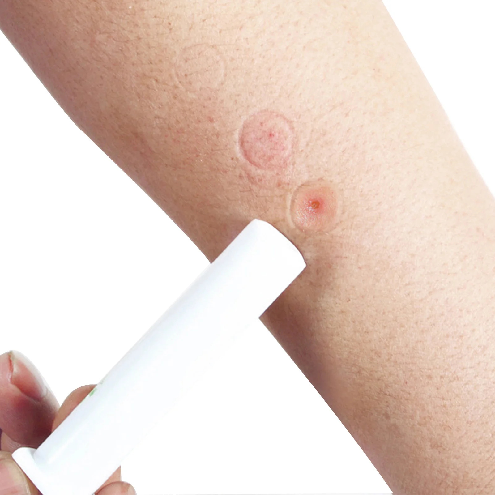 Инструмент для извлечения яда, для удаления яда, пчел, от укусов змеи и насекомых
Инструмент для извлечения яда, для удаления яда, пчел, от укусов змеи и насекомых