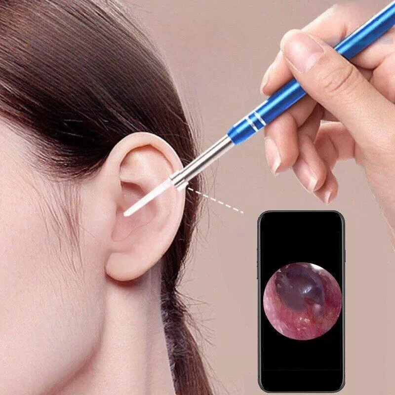 Advanced Ear Cleaning Tool Visible Convenient Ear Spoon Glowing Professional Tool for Children Non-Disposable Reusable
Advanced Ear Cleaning Tool Visible Convenient Ear Spoon Glowing Professional Tool for Children Non-Disposable Reusable