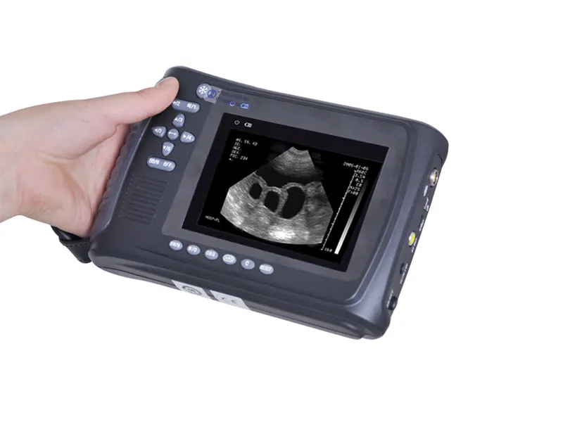 Portable Type B Electric Handheld Scanner Durable Ultrasound Ultrasound Instrument
Portable Type B Electric Handheld Scanner Durable Ultrasound Ultrasound Instrument