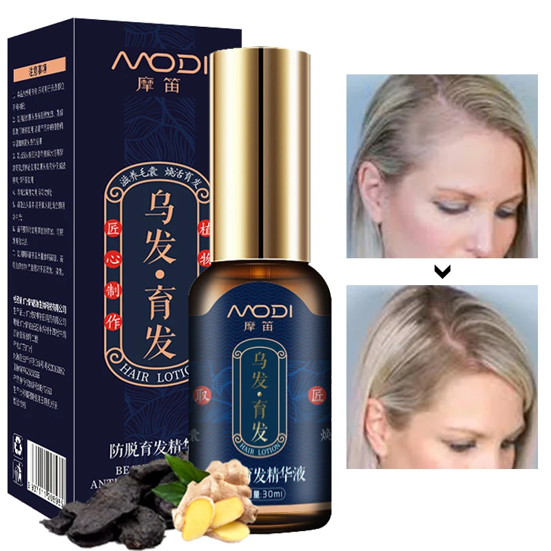 Hair Growth Essence Supplementary Nutrition Repair Damaged Hair Follicles Promote Hair Growth Prevent Hair Loss Hair Care 30ml
Hair Growth Essence Supplementary Nutrition Repair Damaged Hair Follicles Promote Hair Growth Prevent Hair Loss Hair Care 30ml