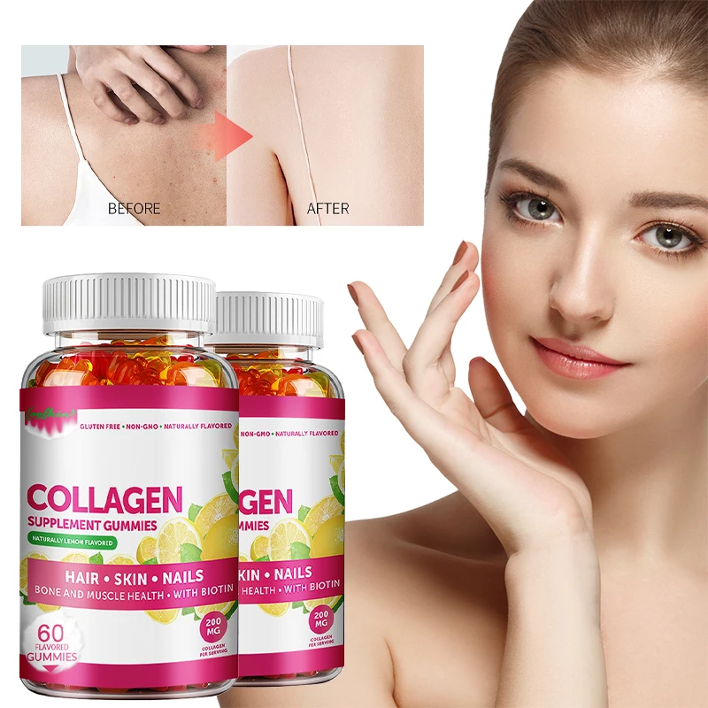 Collagen Gummies - Helps Maintain Healthy Skin, Promotes Healthy Hair and Nails, and Boosts Immune Resistance
Collagen Gummies - Helps Maintain Healthy Skin, Promotes Healthy Hair and Nails, and Boosts Immune Resistance