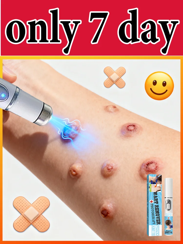 Gᴇɴᴇʀᴀᴛɪᴏɴ-3 Lᴀsᴇʀ Sᴀʏs Gᴏᴏᴅʙʏᴇ Tᴏ Wᴀʀᴛs Iɴ 7 Dᴀʏs
Gᴇɴᴇʀᴀᴛɪᴏɴ-3 Lᴀsᴇʀ Sᴀʏs Gᴏᴏᴅʙʏᴇ Tᴏ Wᴀʀᴛs Iɴ 7 Dᴀʏs