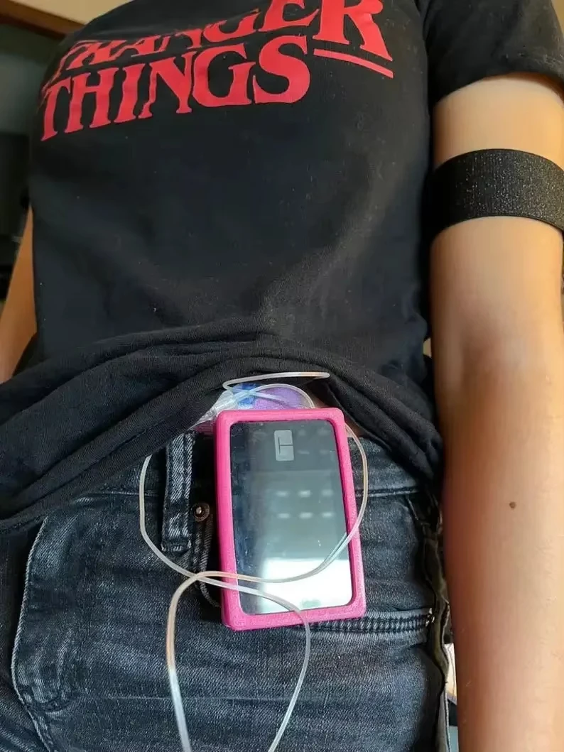 T Pump Protective Shell Flexible Silicone Material T SLIM Insulin Pump Protective Shell
T Pump Protective Shell Flexible Silicone Material T SLIM Insulin Pump Protective Shell