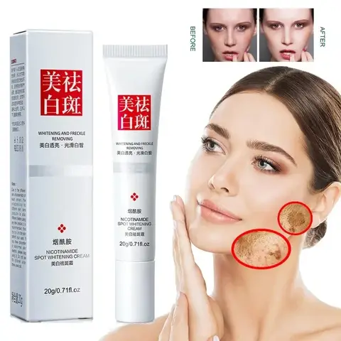 Crema facial que se desvanece, pecas, manchas oscuras, niacinamida, crema blanqueadora, vitamina E, mejora la embotamiento, brillo rápido, nutre el cuidado de la piel