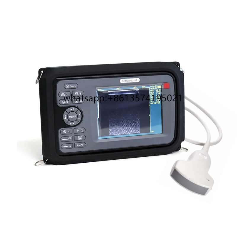 Sheep USG Pig Rectal Probe Animal Echo Scannerest Portable Sheep Ultrasound Scanner Veterinary Sonar Scanner
Sheep USG Pig Rectal Probe Animal Echo Scannerest Portable Sheep Ultrasound Scanner Veterinary Sonar Scanner