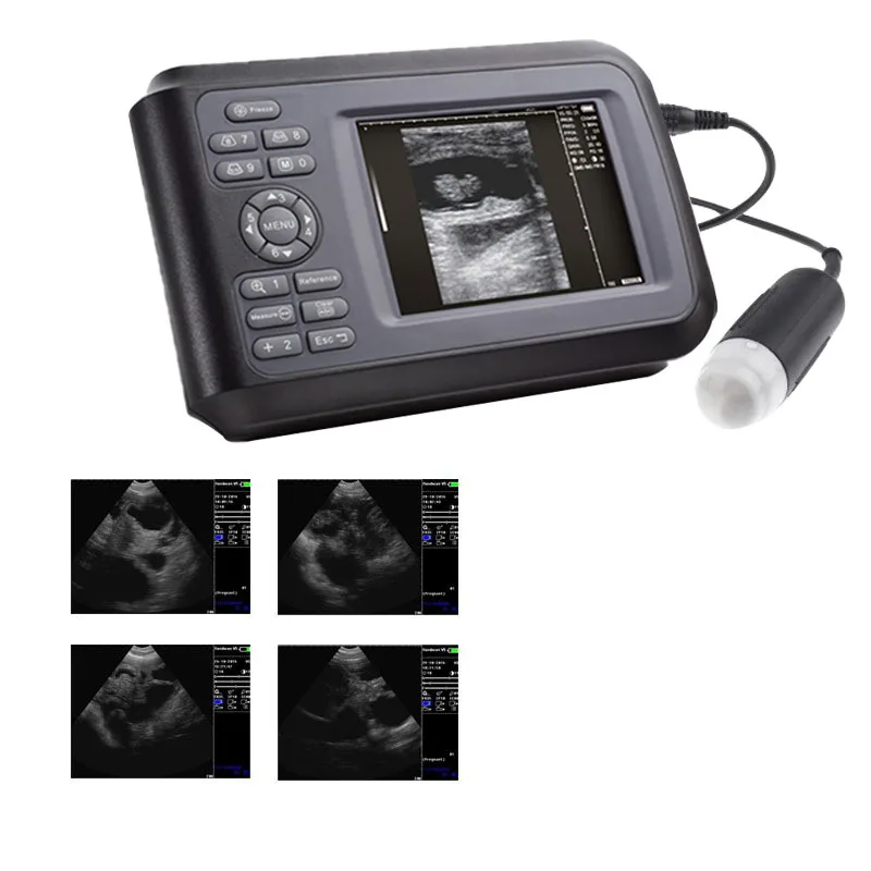 Animal Ultrasound Diagnostic Instrument Mechanical Probe Pregnancy Test Sheep Dog Cat Dog Pet Ultrasound Pregnancy
Animal Ultrasound Diagnostic Instrument Mechanical Probe Pregnancy Test Sheep Dog Cat Dog Pet Ultrasound Pregnancy