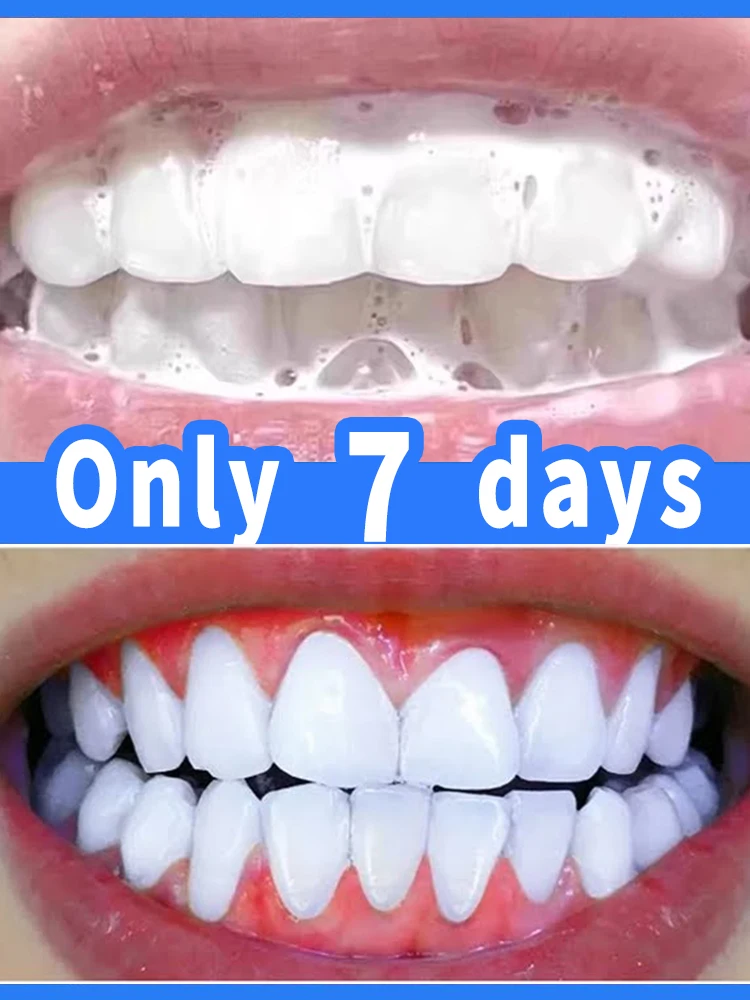 Tartar removers dissolve tartar and remove stains in 2025
Tartar removers dissolve tartar and remove stains in 2025