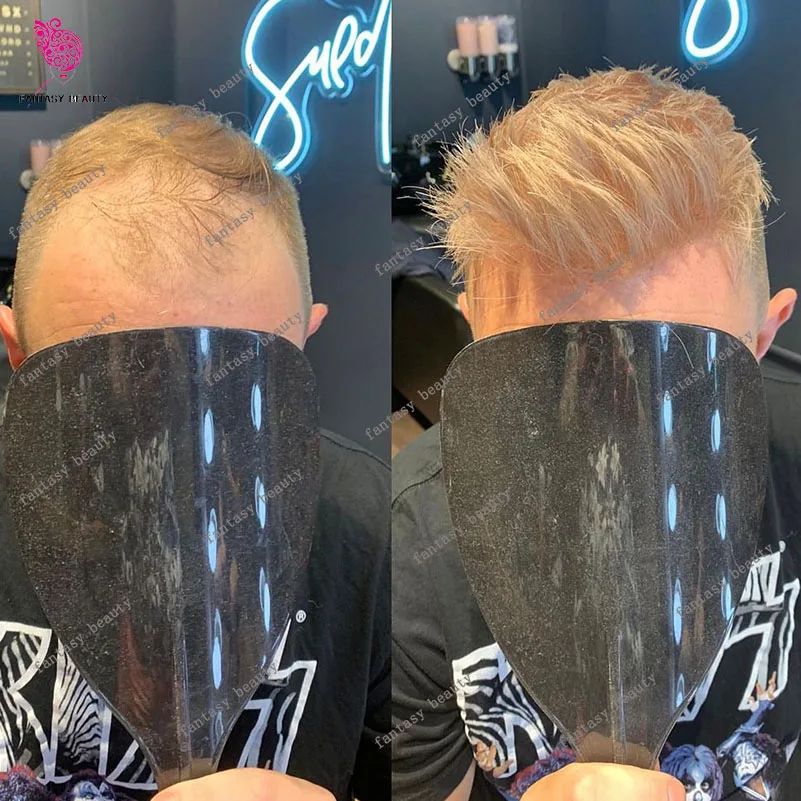 Super Thin Skin 0.04mm Men's Toupee Ash Blonde White Men Capillary Prosthesi Natural Hairline Replacement System Human Hair Wig
Super Thin Skin 0.04mm Men's Toupee Ash Blonde White Men Capillary Prosthesi Natural Hairline Replacement System Human Hair Wig
