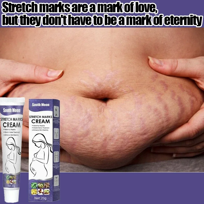 Stretch Mark Removal Cream Permanently Removes Stretch Marks Rejuvenates Skin Stretch Mark Removal Cream
Stretch Mark Removal Cream Permanently Removes Stretch Marks Rejuvenates Skin Stretch Mark Removal Cream