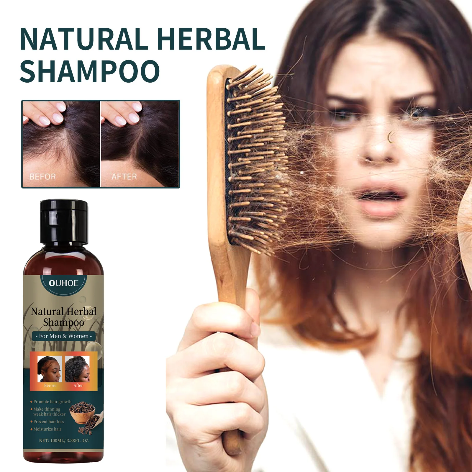 2 pcs Promote Hair Growth Shampoo, Deep Cleansing Scalp Repair Hair Follicle Damage Strengthen Hair
2 pcs Promote Hair Growth Shampoo, Deep Cleansing Scalp Repair Hair Follicle Damage Strengthen Hair