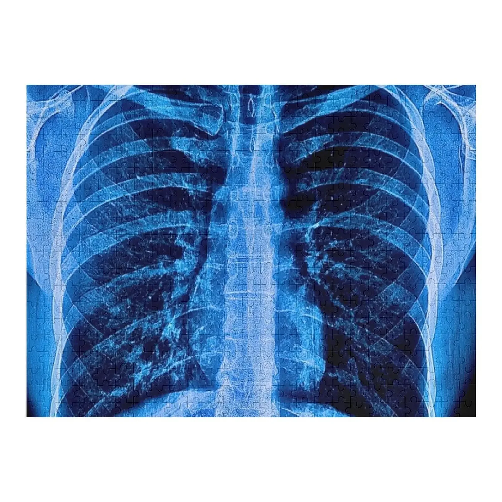 Chest X-Ray Jigsaw Puzzle For Children Personalized Toy Customized Kids Gift Puzzle 
Chest X-Ray Jigsaw Puzzle For Children Personalized Toy Customized Kids Gift Puzzle