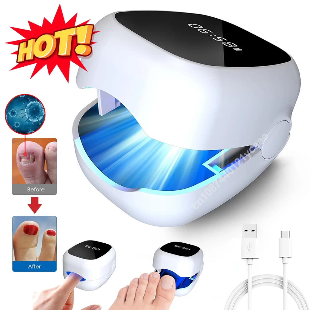 Nail Fungus Laser LED Light Device Fungal Nail Treatment Anti-Equipment Effectively Remove Fungal Toenail Nail Fungal Infection
Nail Fungus Laser LED Light Device Fungal Nail Treatment Anti-Equipment Effectively Remove Fungal Toenail Nail Fungal Infection