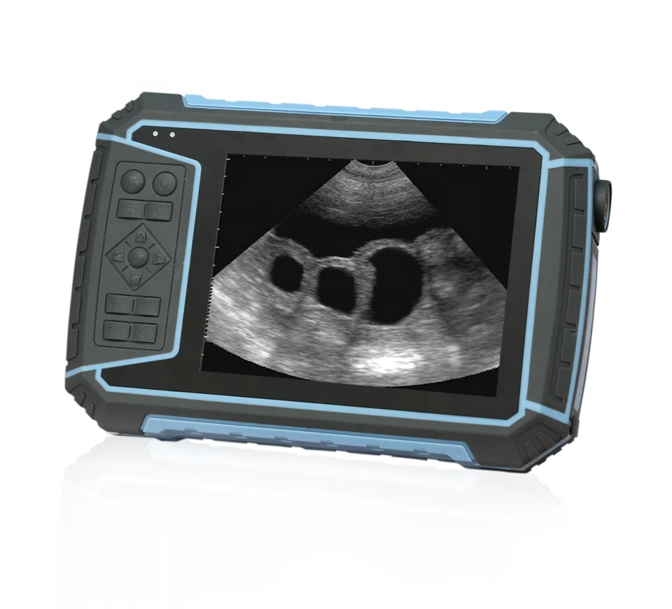 TOP-A1007C 5.7"TFT-LCD Waterproof Portable Handheld Veterinary Ultrasound Scanner Machine for Sheep, Goat, Horse, Dog
TOP-A1007C 5.7"TFT-LCD Waterproof Portable Handheld Veterinary Ultrasound Scanner Machine for Sheep, Goat, Horse, Dog