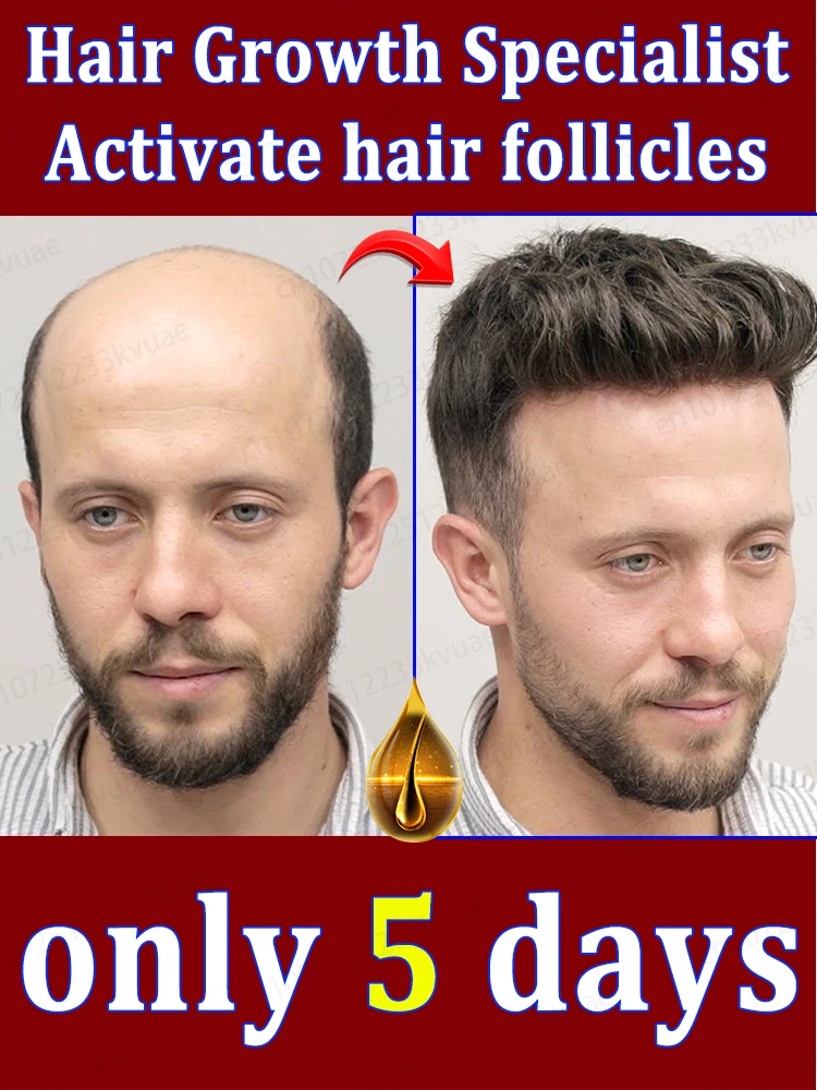 Say goodbye to baldness, hair growth essential oil will make your hair grow so long that the comb will burst
Say goodbye to baldness, hair growth essential oil will make your hair grow so long that the comb will burst
