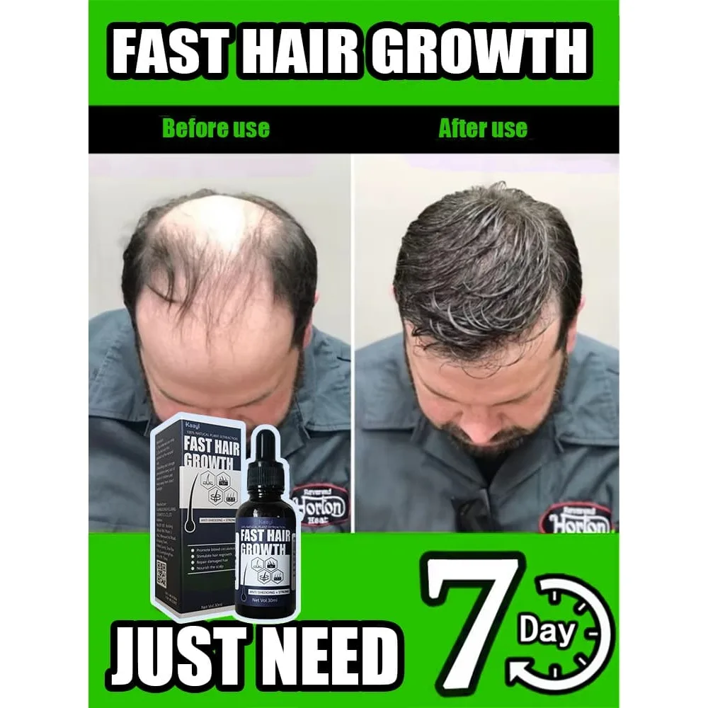 Hair Growth Supplements| Stimulate Growth for Hair| Clinically Tested for Thicker Hair
Hair Growth Supplements| Stimulate Growth for Hair| Clinically Tested for Thicker Hair