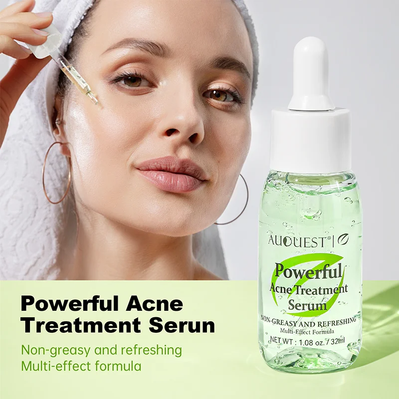 Powerful Acne Treatment Serum Controls Oil Fades Acne Marks Gently Cares Skin Tone Essence Fade Dark Patches Beauty Products
Powerful Acne Treatment Serum Controls Oil Fades Acne Marks Gently Cares Skin Tone Essence Fade Dark Patches Beauty Products