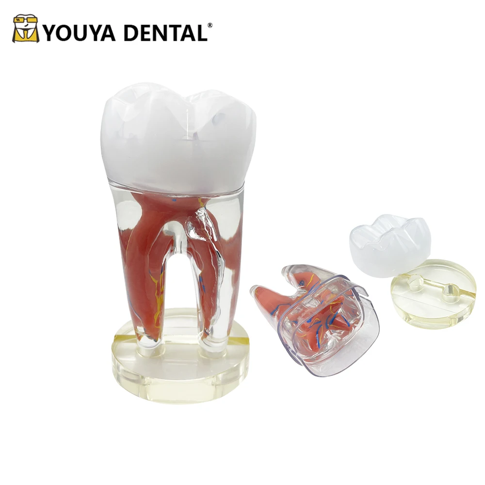 10 Times Endodontic Dental Model Large Clear Tooth Pulp And Nerve Teeth Model Detachable Models For Teaching Studying Education
10 Times Endodontic Dental Model Large Clear Tooth Pulp And Nerve Teeth Model Detachable Models For Teaching Studying Education