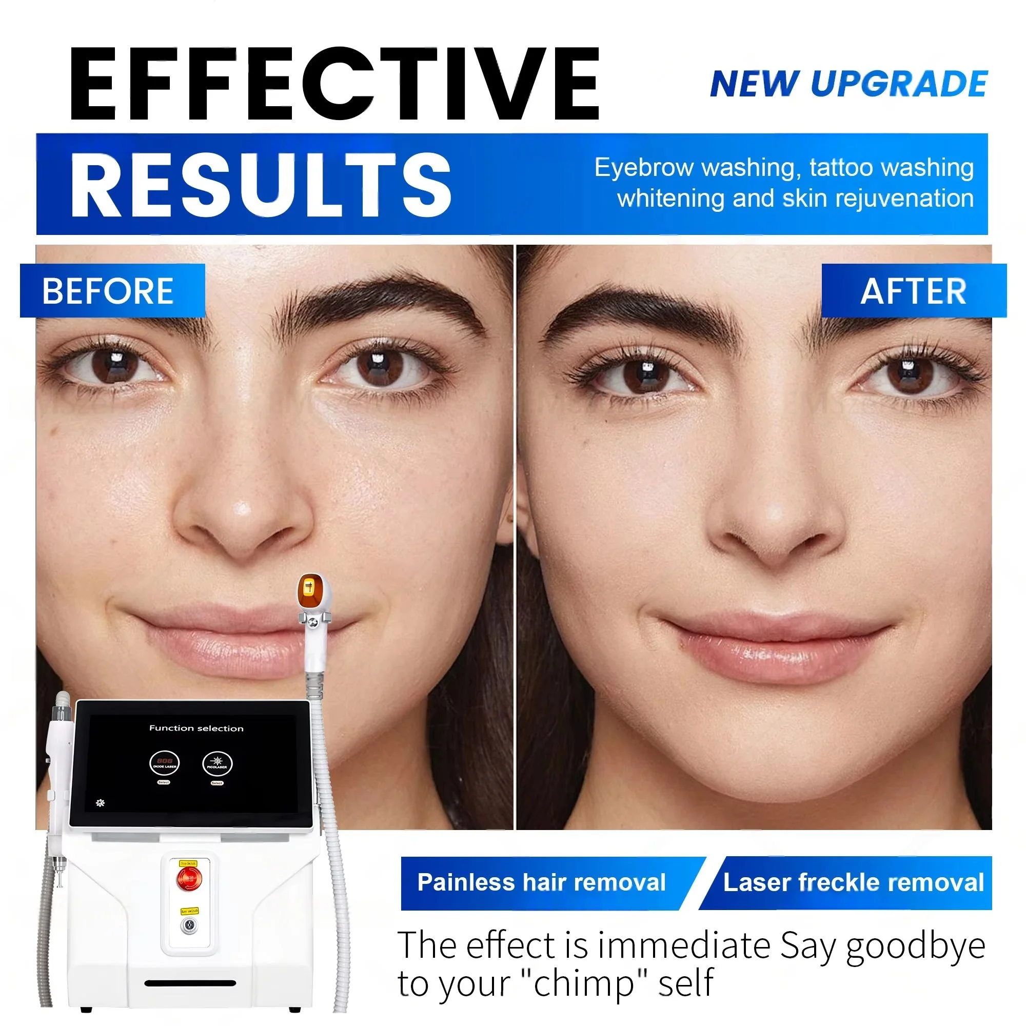 Диодный лазер 3000 Вт и пикосекундный лазер 2-в-1 для удаления волос 755 нм/808 нм/940 нм/1064 нм для удаления татуировок для косметического использования 
Диодный лазер 3000 Вт и пикосекундный лазер 2-в-1 для удаления волос 755 нм/808 нм/940 нм/1064 нм для удаления татуировок для косметического использования