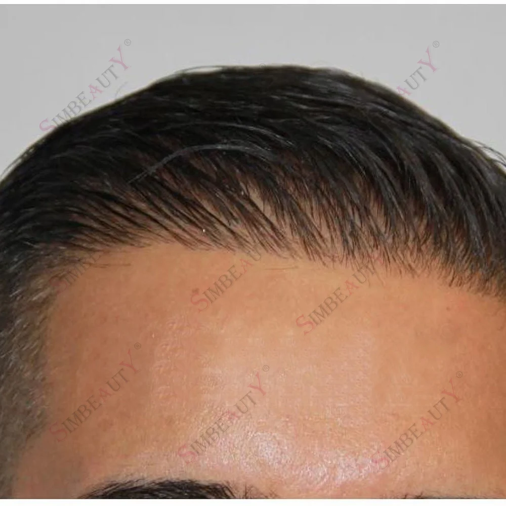 80% Ultra 0.02mmThin Undetectale Toupet Dark Brown Men Toupee Black Gray 1b20 440# Human Hair System Natural Hairline Prosthesis
80% Ultra 0.02mmThin Undetectale Toupet Dark Brown Men Toupee Black Gray 1b20 440# Human Hair System Natural Hairline Prosthesis