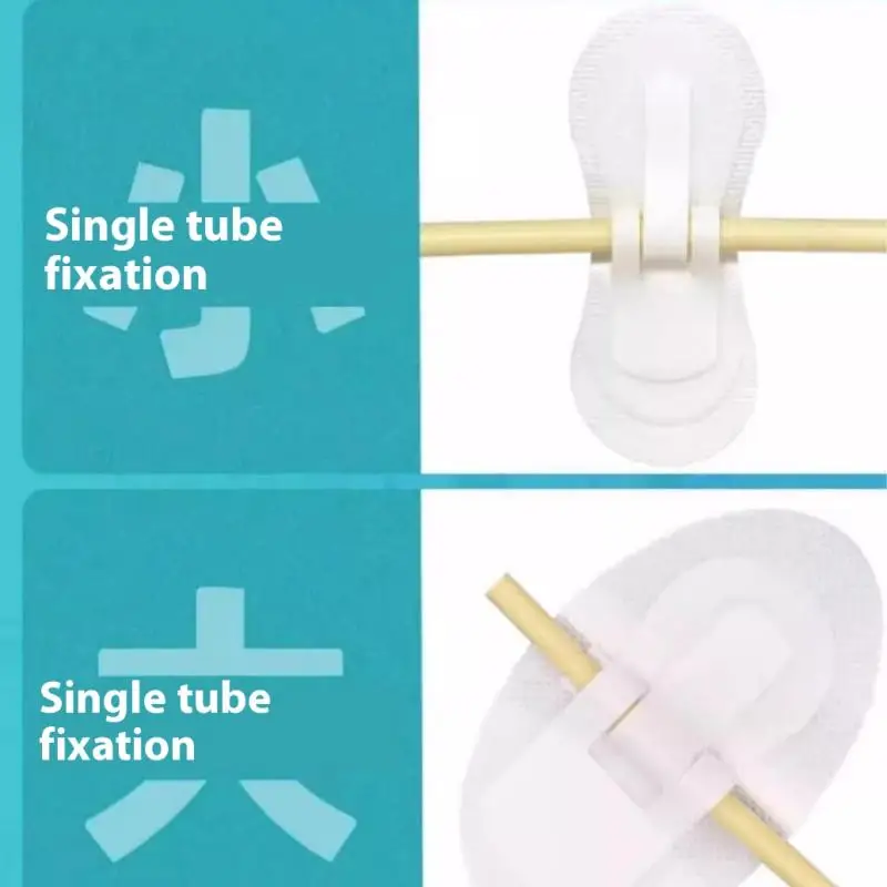 Catheter Urinary Legband Holder Foam Anchor Pad Adhesive Hook Loop Stabilization Device Dressing EOS Disinfecting Type Urine Bag
Catheter Urinary Legband Holder Foam Anchor Pad Adhesive Hook Loop Stabilization Device Dressing EOS Disinfecting Type Urine Bag